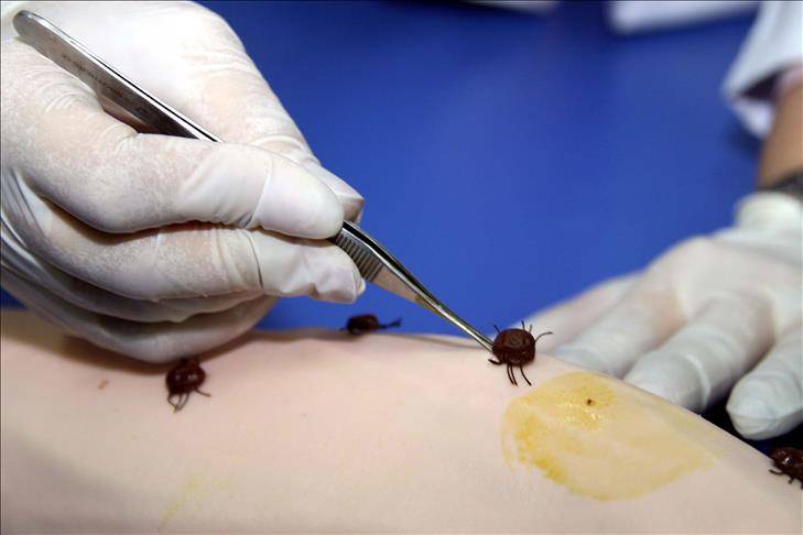 Küçücük bir ısırıkla başlıyor! Uzmanlar Lyme hastalığı için uyardı 4